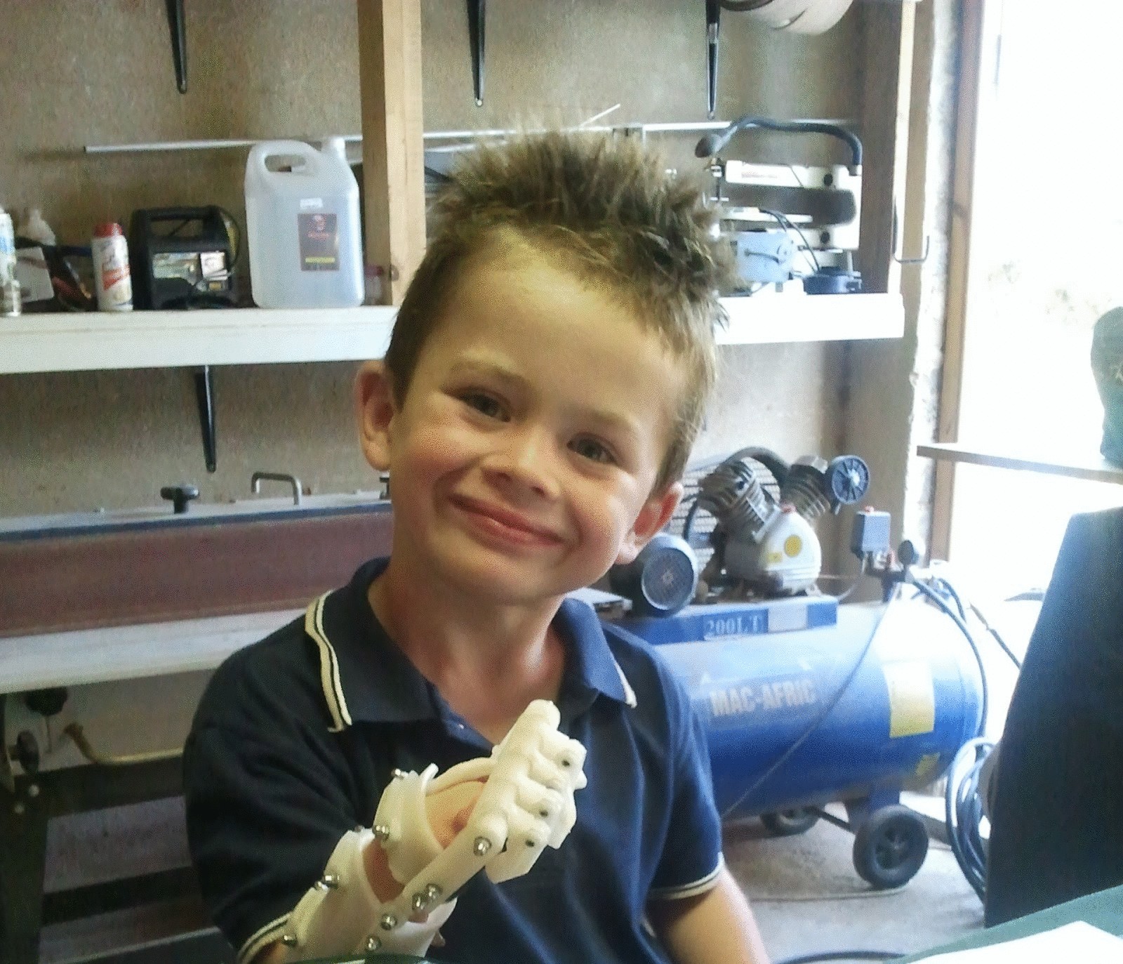 3D-принтер напечатал руку для семилетнего украинского мальчика
