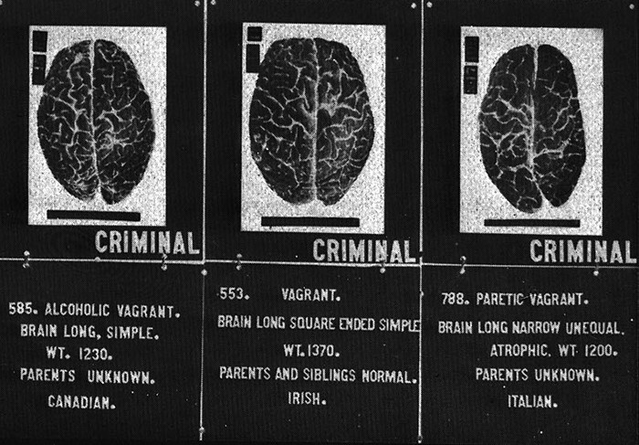 Нейробиология насилия: как устроен мозг преступника