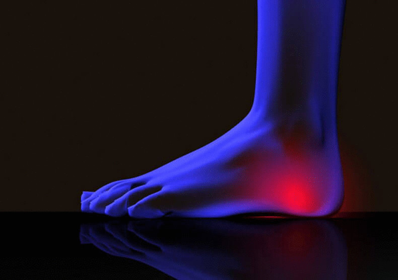 Боль в пятке - тревожный сигнал организма