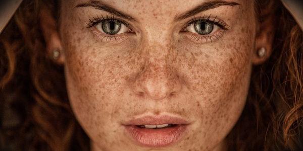 Болезни кожи — ПСИХОЛОГИЧЕСКИЕ причины