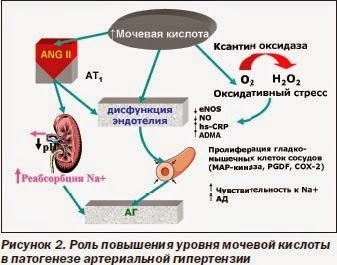 Высокий уровень мочевой кислоты —мощный фактор риска ожирения, старческого слабоумия и не только!