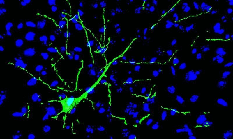 Пересаженные нервные клетки встроились в мозг