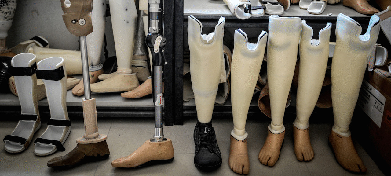 Создан протез ноги, который интегрируется прямо в кость