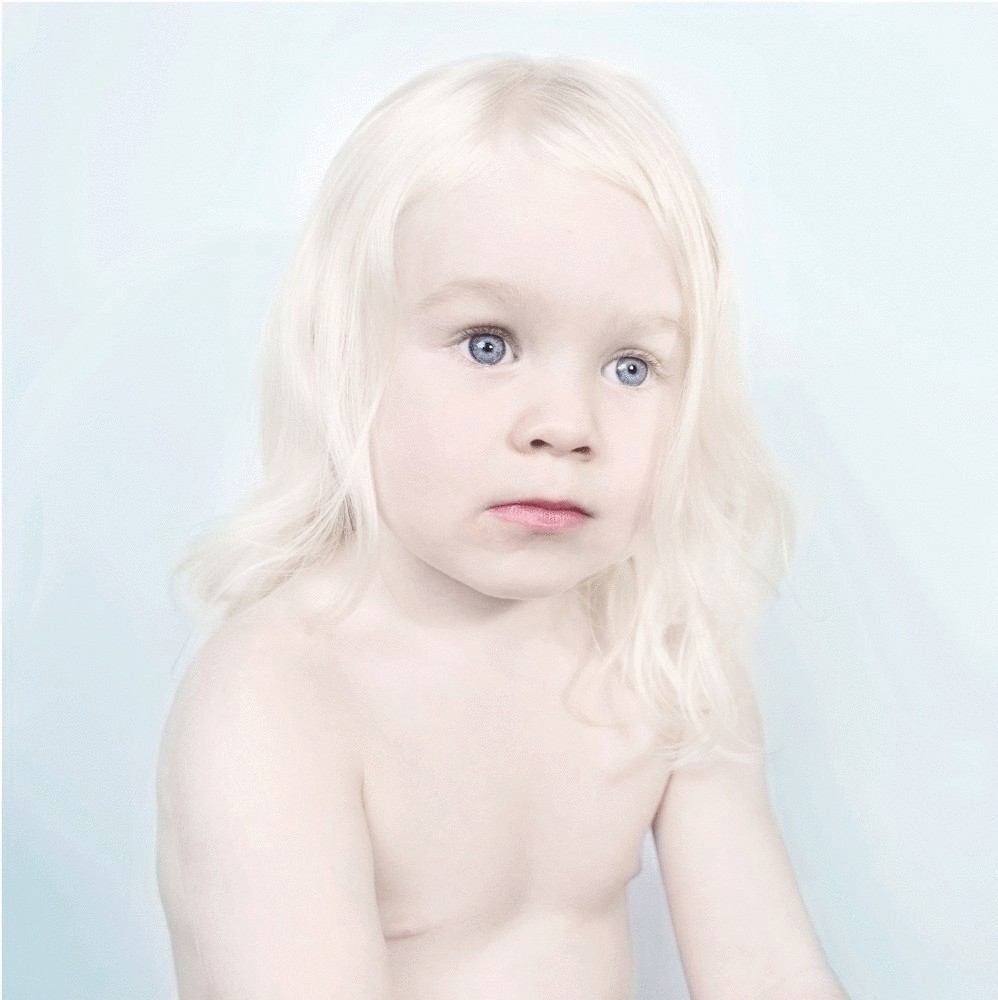 Люди-альбиносы в фотопроекте Сане Де Вайлд 