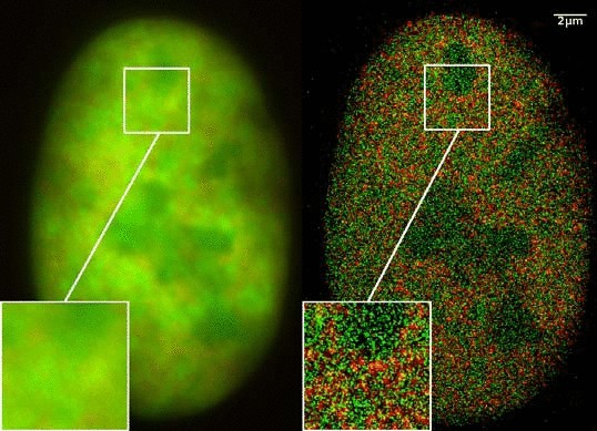 Нобелевскую премию по химии дали за флуоресцентную микроскопию высокого разрешения