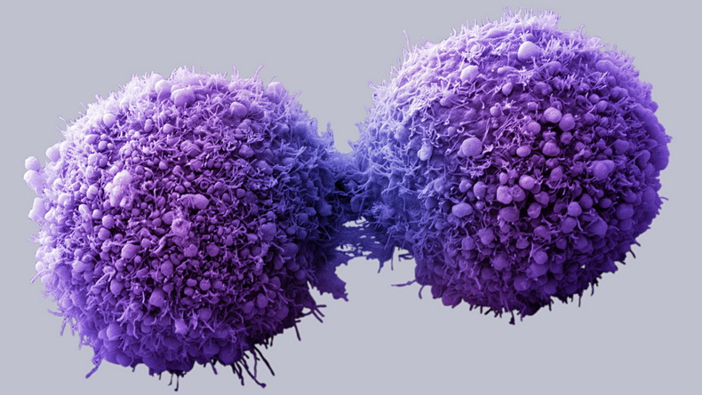 Невезение — более вероятная причина рака, нежели образ жизни или гены